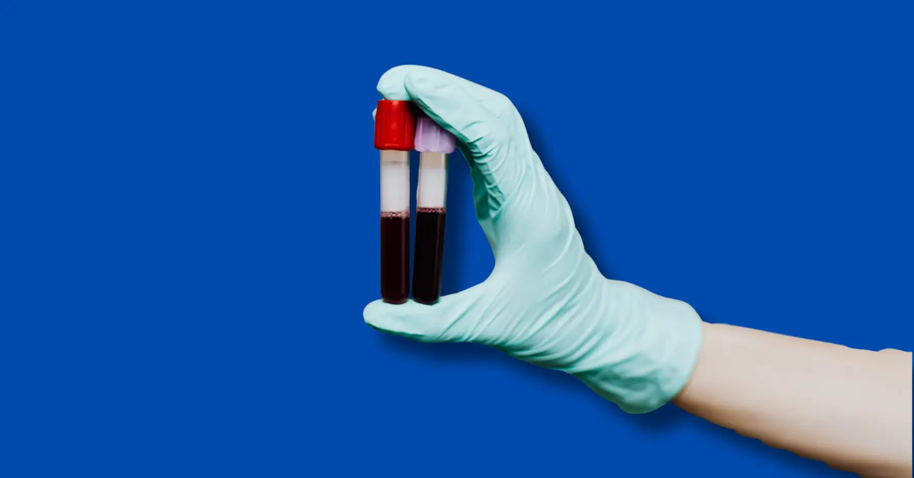 is blood a biohazard